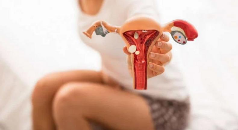 Screenshot 2025-07-10 at 09-20-27 Novas opções de tratamento para endometriose serão oferecidas pelo SUS
