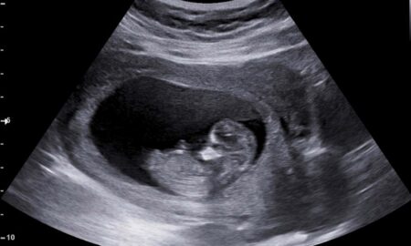 IMAGEM_4