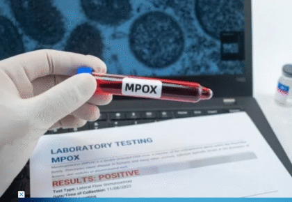 Screenshot 2026-02-25 at 08-56-39 Mpox Brasil chega a 90 casos com mais dois estados na lista