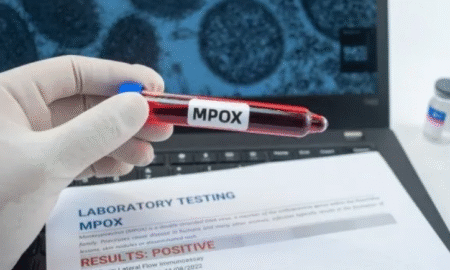 Screenshot 2026-02-25 at 08-56-39 Mpox Brasil chega a 90 casos com mais dois estados na lista