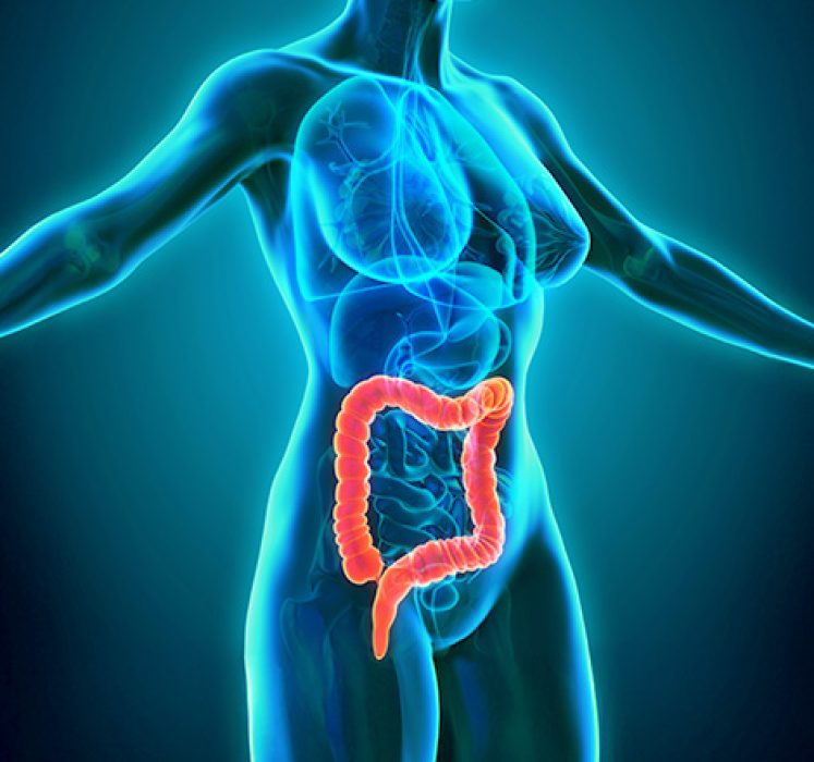 Cancer-Colorretal-destaque Cancer-Colorretal-destaque